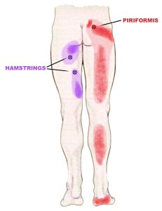 Hip and buttock pain while driving - Hip Pain Help